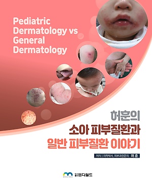 허훈의 소아 피부질환과 일반 피부질환 이야기=Pediatric dermatology vs general dermatology