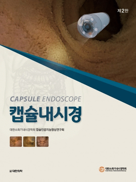 캡슐내시경 =Capsule endoscope