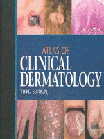 Atlas of clinical dermatology